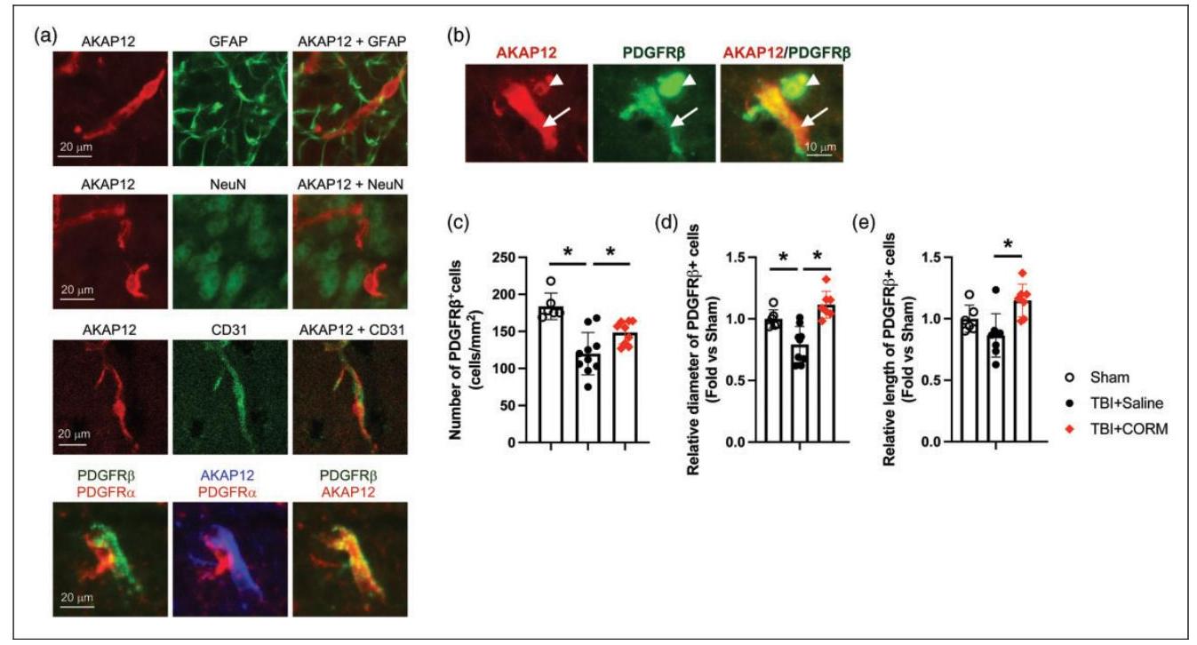 A-kinase anchor protein 12 promotes oligodendrogenesis and cognitive ...